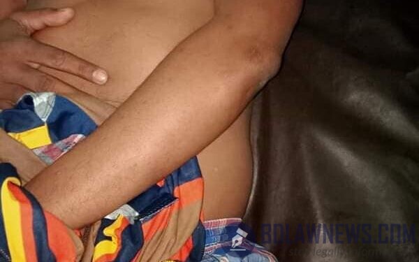 শেষ রাতে জাতীয় প্রেসক্লাবে ঘুমন্ত অবস্থায় শিক্ষানবিশের উপর পুলিশের হামলা